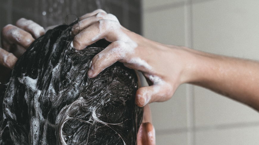 Trockene Kopfhaut: Diese 5 Shampoos helfen sofort