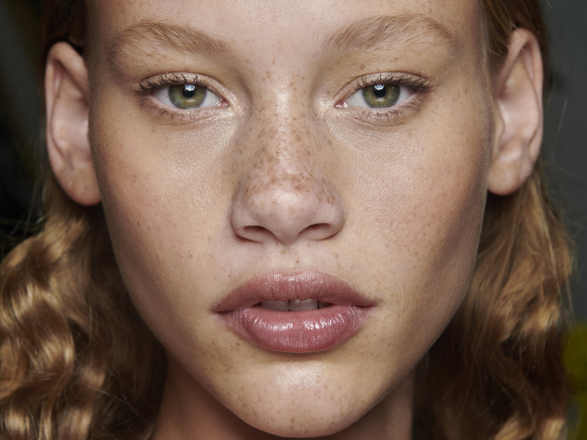 Model mit Sommersprossen
