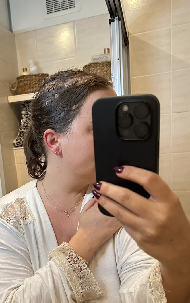 Etwa fünf Wochen nach Start der Chemotherapie hat der Haarausfall begonnen. Ab jetzt lässt sich der Krebs nicht mehr verstecken.