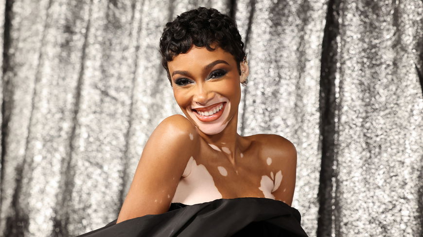Winnie Harlow im Interview: "Deine Meinung über dich selbst ist wichtiger als die Meinung anderer über dich"