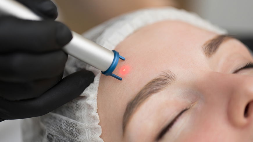 Anti-Akne Laser: Alles, was du über die Behandlung wissen musst – laut Dermatologe