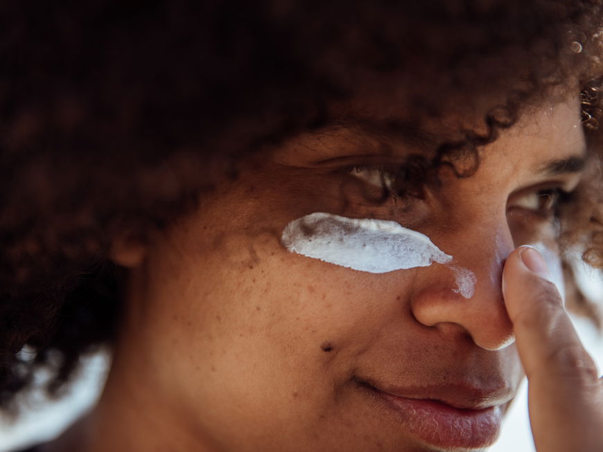 Pickel von Sonnencreme: Frau trägt sich Sonnenschutz auf das Gesicht auf