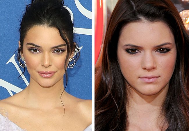 Kendall Jenner