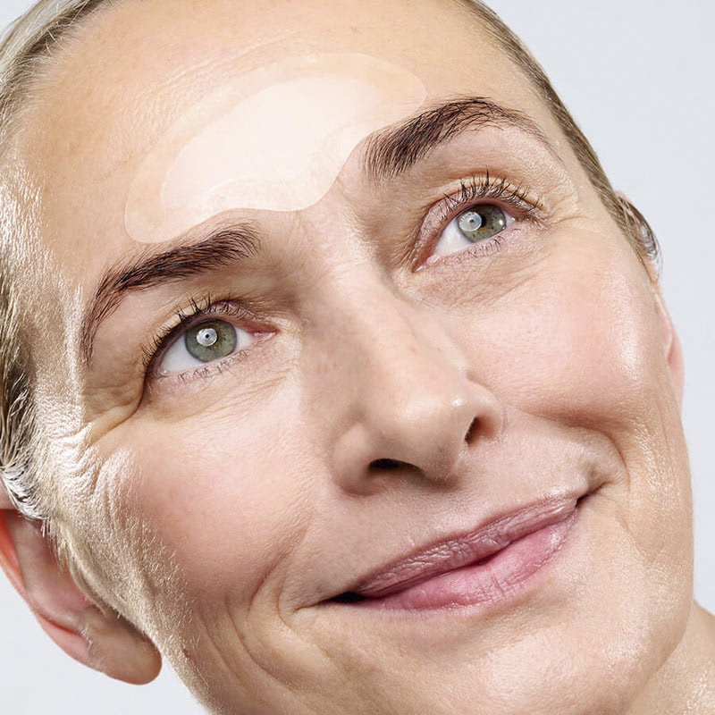 Radiofrequenz Microneedling Patches