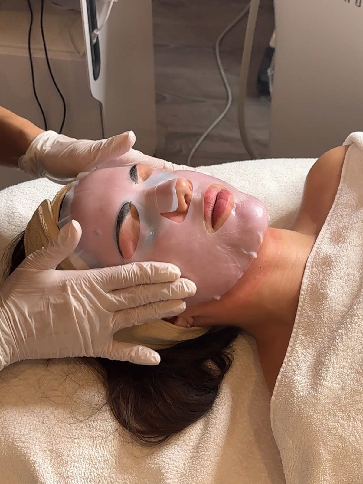 Radiofrequenz-Microneedling