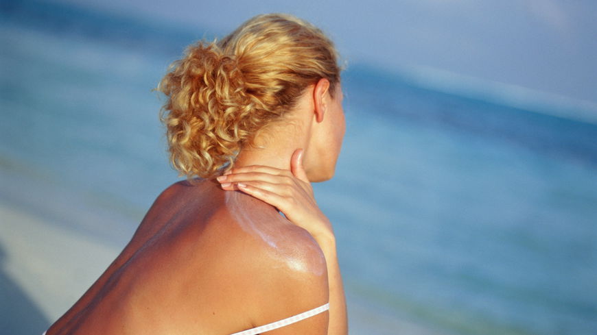Sonnenbrand richtig behandeln: Tipps aus der Redaktion