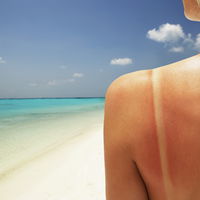 Tan Lines sind wieder in: Was dahinter steckt und warum man nicht jeden Trend mitmachen sollte