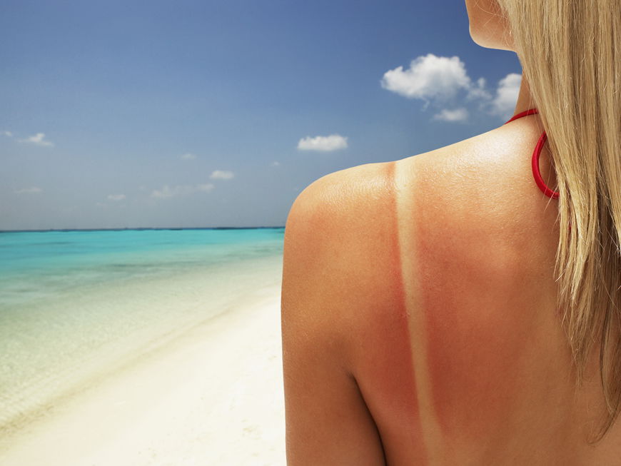Tan Lines