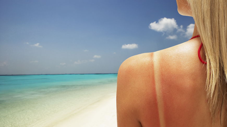 Tan Lines sind wieder in: Was dahinter steckt und warum man nicht jeden Trend mitmachen sollte