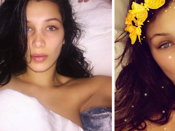 Hatte Bella Hadid eine Nasen-Op?