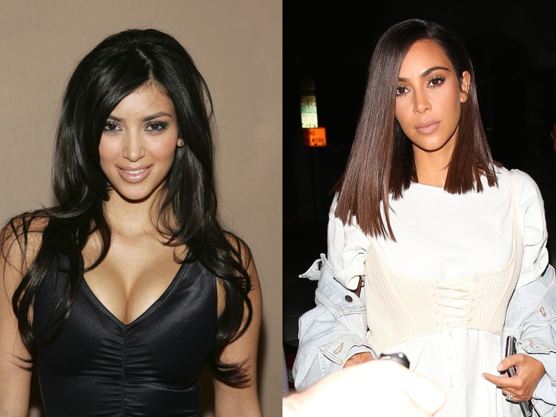 Kim Kardashian vorher nachher