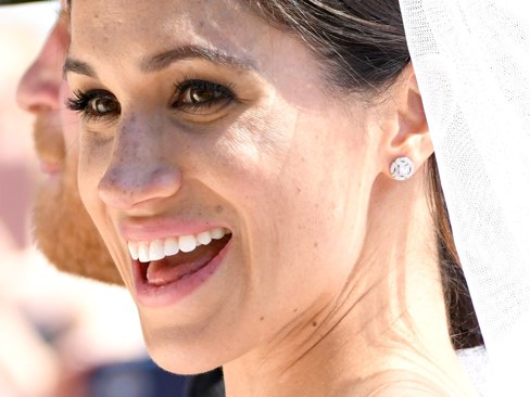 Meghan-Markle-Sommersprossen