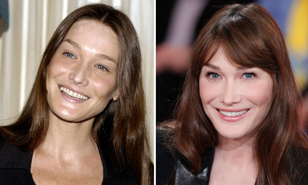 Carla Bruni früher heute