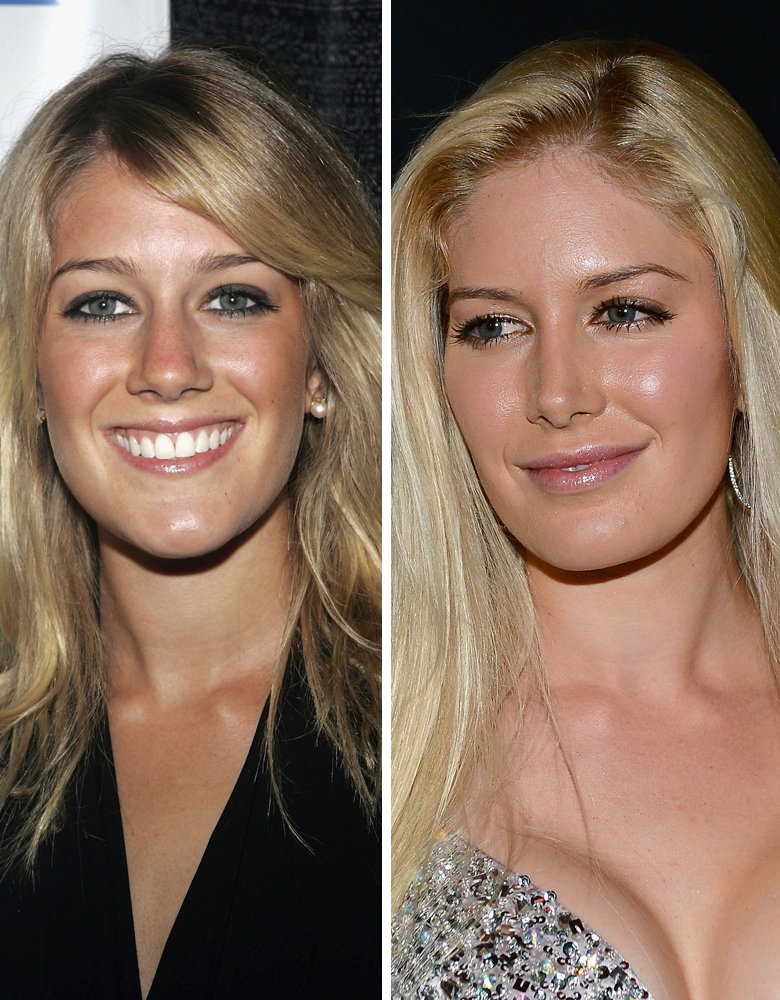 Heidi Montag: 2006 und 2013