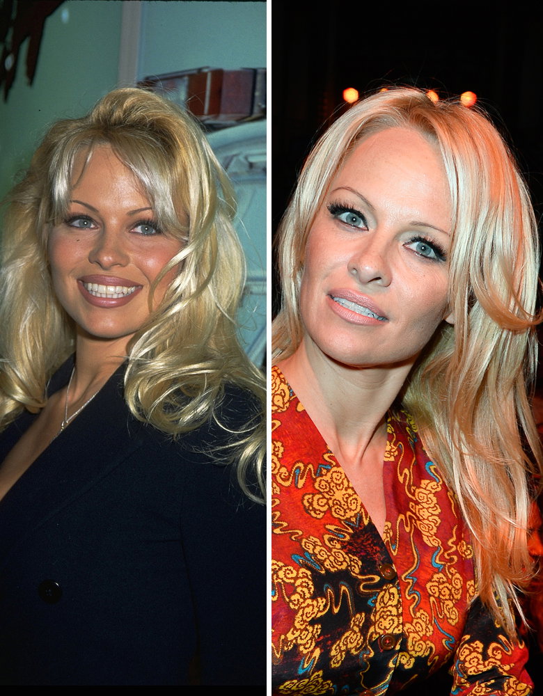 Nicole Kidman: 1992 und 2013