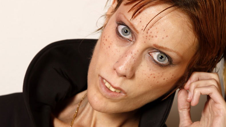 Magermodel Isabelle Caro ist tot