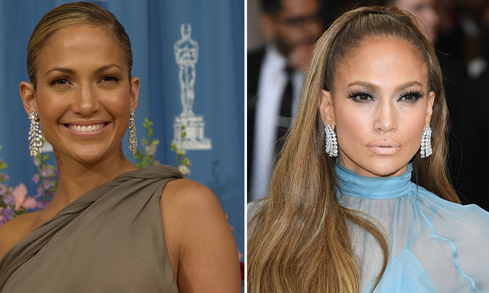 Jennifer Lopez' Gesicht früher und heute