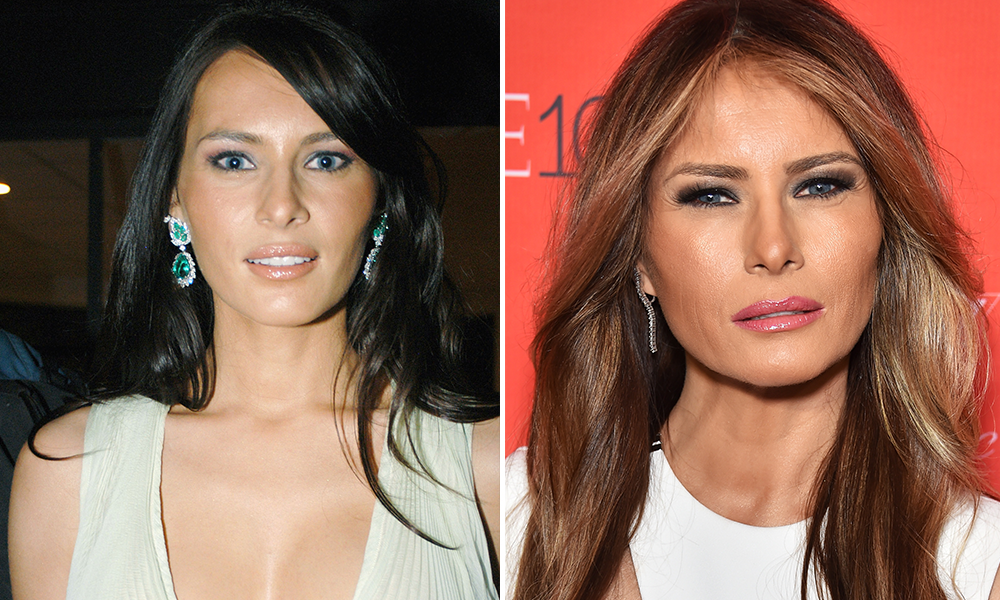 Melania Trump früher heute