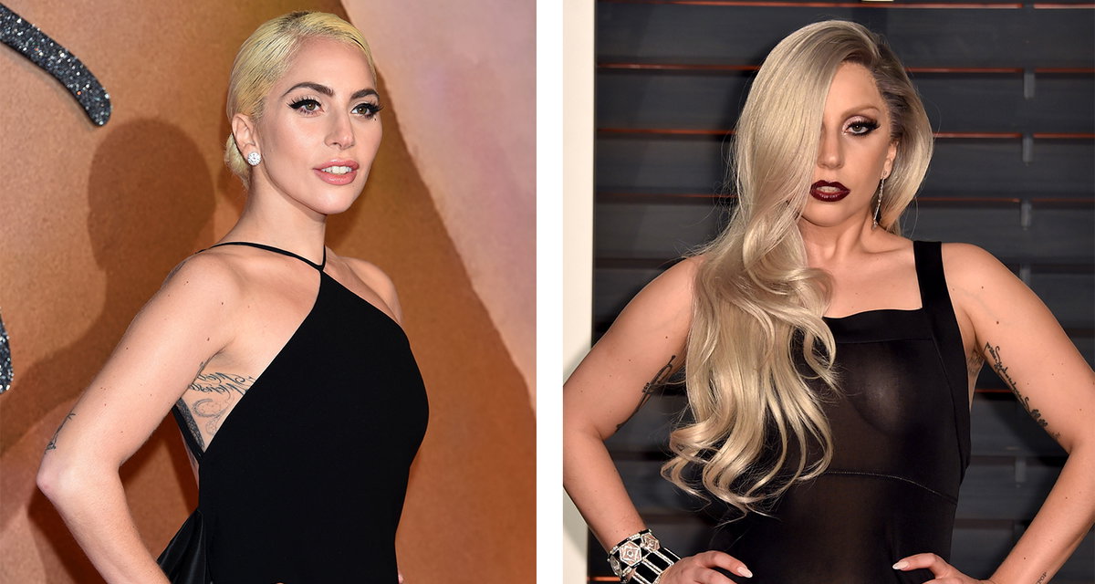 Lady Gaga Abnehmen Vorher-Nachher