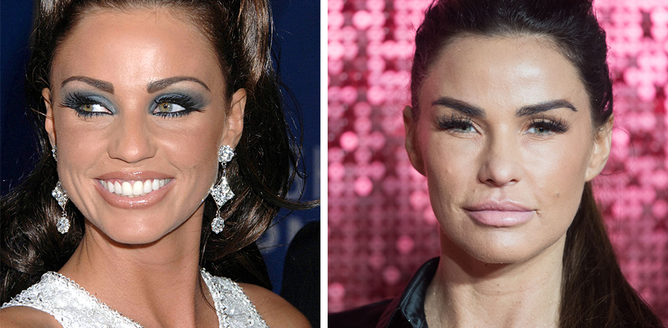 Katie Price früher heute