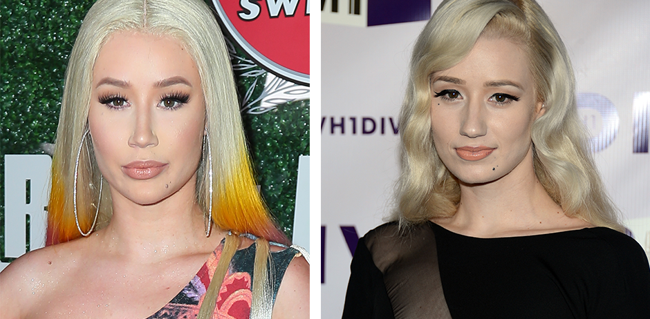 Iggy Azalea operiert und früher