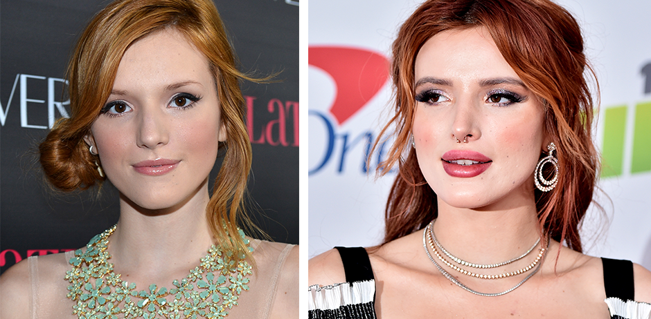 Bella Thorne operiert und vorher