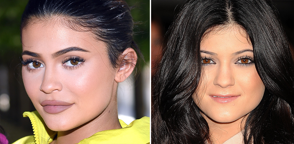 Kylie Jenner früher und heute