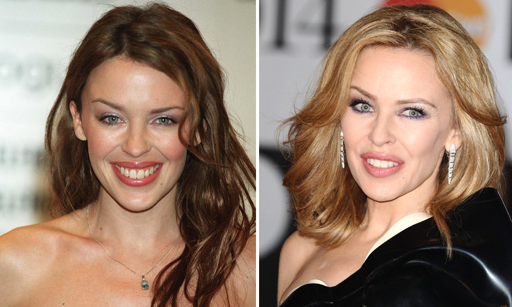 Kylie Minogue früher heute