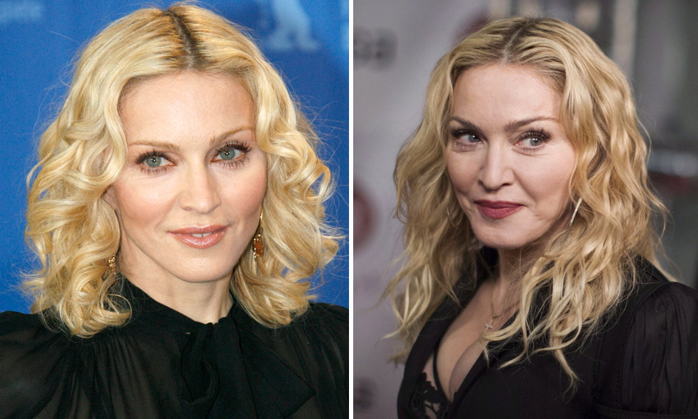 Madonna früher heute