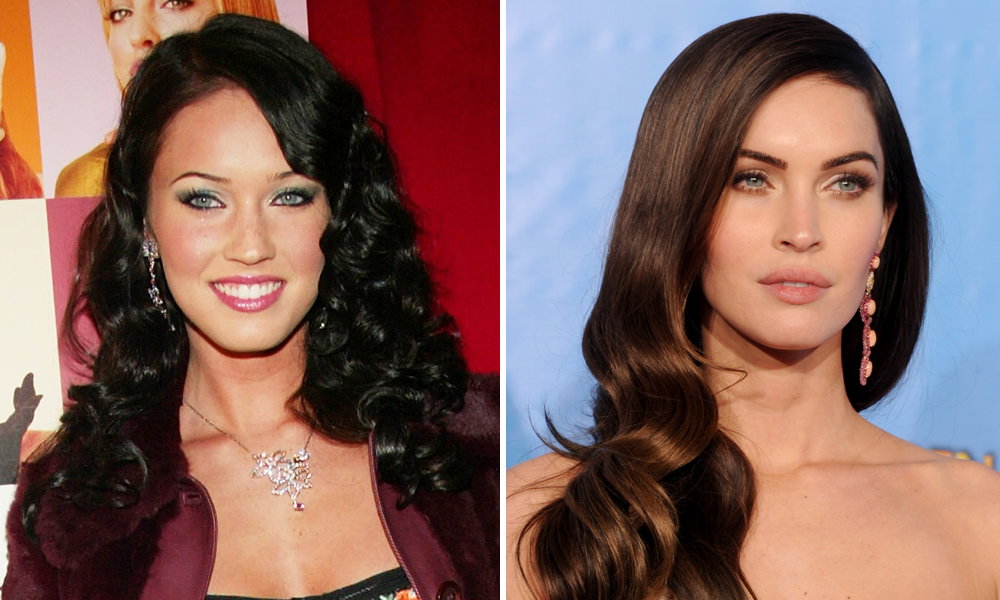 Megan Fox vor OPs und danach