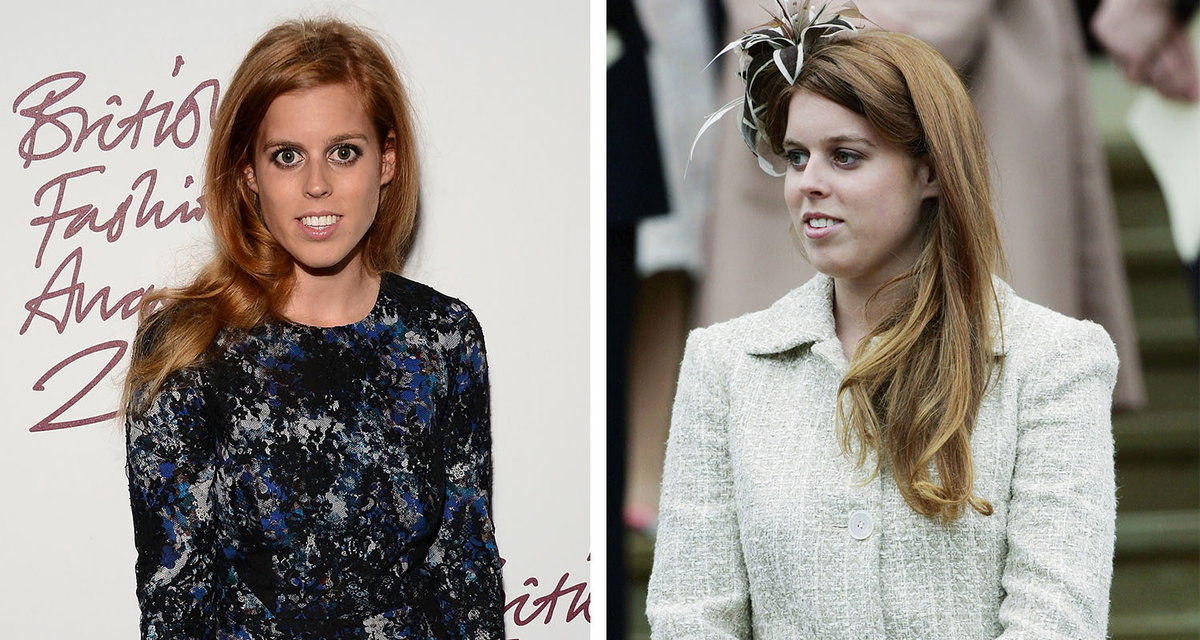 Prinzessin Beatrice Abnehmen Vorher-Nachher