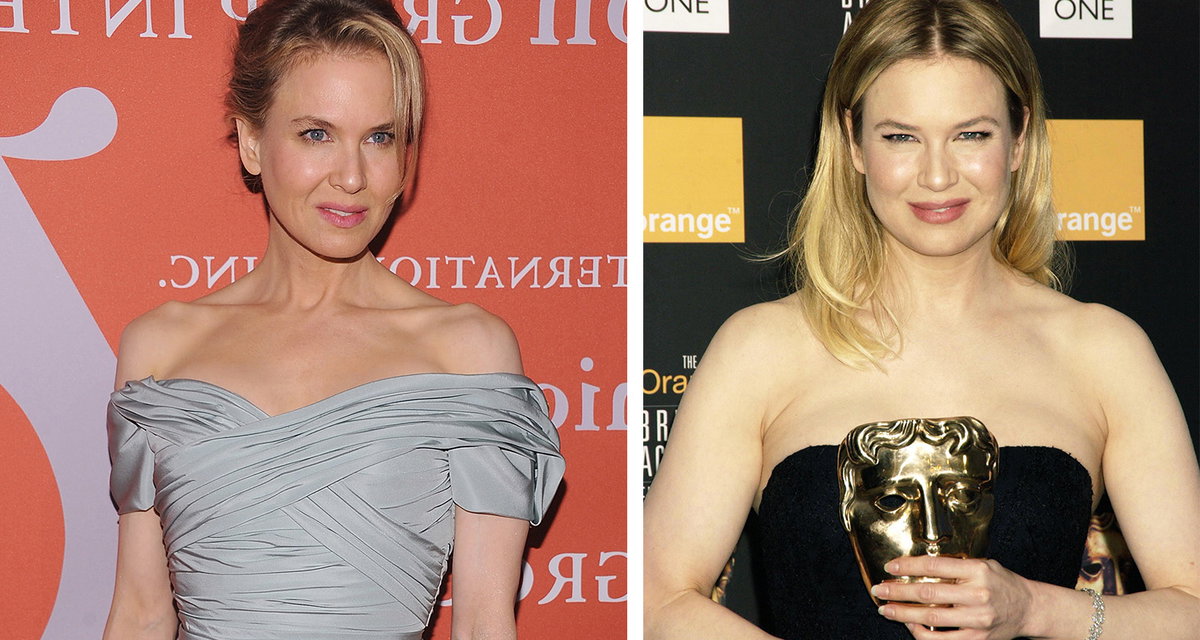 Renee Zellweger Abnehmen Vorher-Nachher