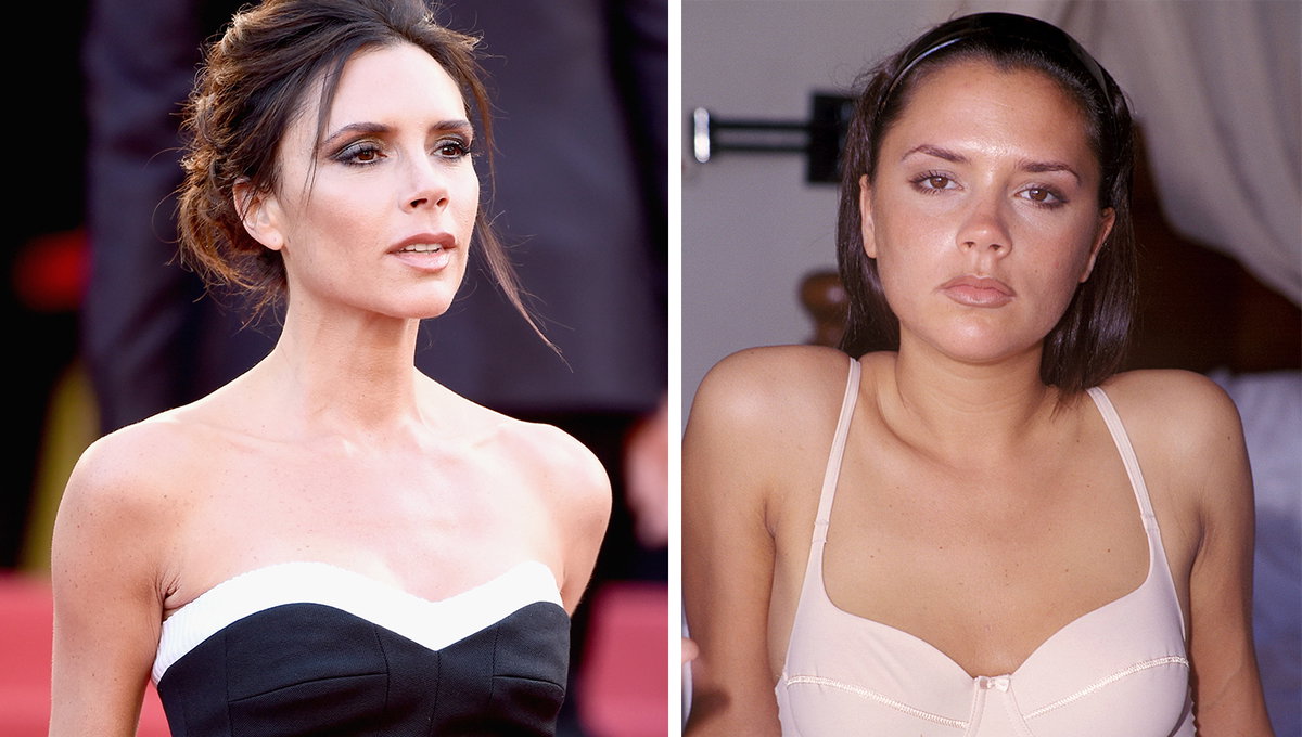 Victoria Beckham Abnehmen Vorher-Nachher