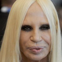 Autsch! Was ist mit Donatella Versaces Gesicht los?