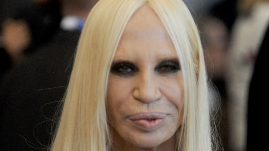 Autsch! Was ist mit Donatella Versaces Gesicht los?