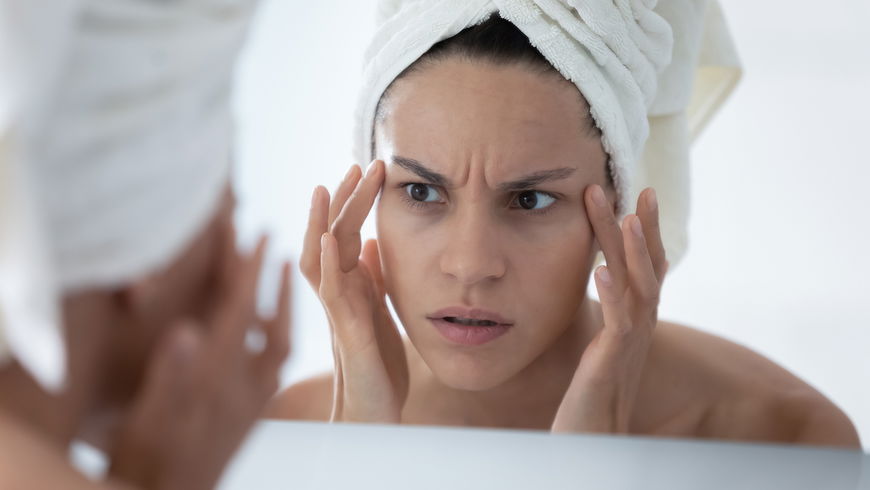 Augenringe aufhellen: 5 wirksame Tipps gegen müde Augen