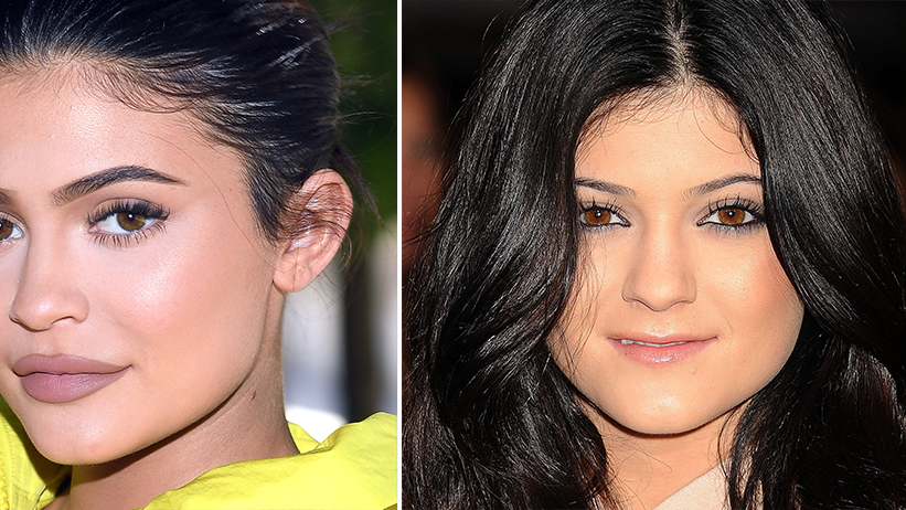 Kylie Jenner: Die Beauty-Transformation des Reality-Stars