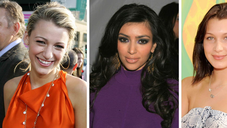 Nasen-OPs der Stars: Diese Promi-Ladies hatten einen Nose-Job
