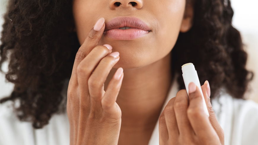 Trockene Lippen im Winter: Diese Mittel helfen wirklich!