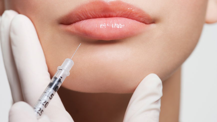 Lippen aufspritzen: Der ultimative Ratgeber mit Tipps vom Chirurgen